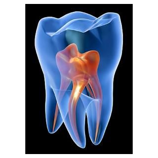 Wall Art  Posters  Molar tooth Poster