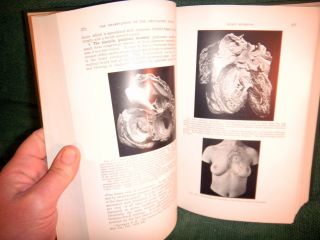 1933 MEDICAL BOOK  DISEASES OF THE CHEST & PRINCIPLES OF PHYSICAL