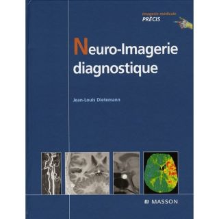 Neuro imagerie diagnostique   Achat / Vente livre Jean Louis