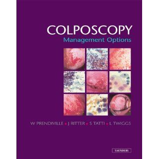 Colposcopy Management Options Walter Prendiville, Jean
